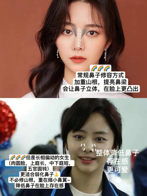 鼻翼韩国不花钱方法不开刀高鼻梁(鼻翼韩国方法鼻子不花钱)