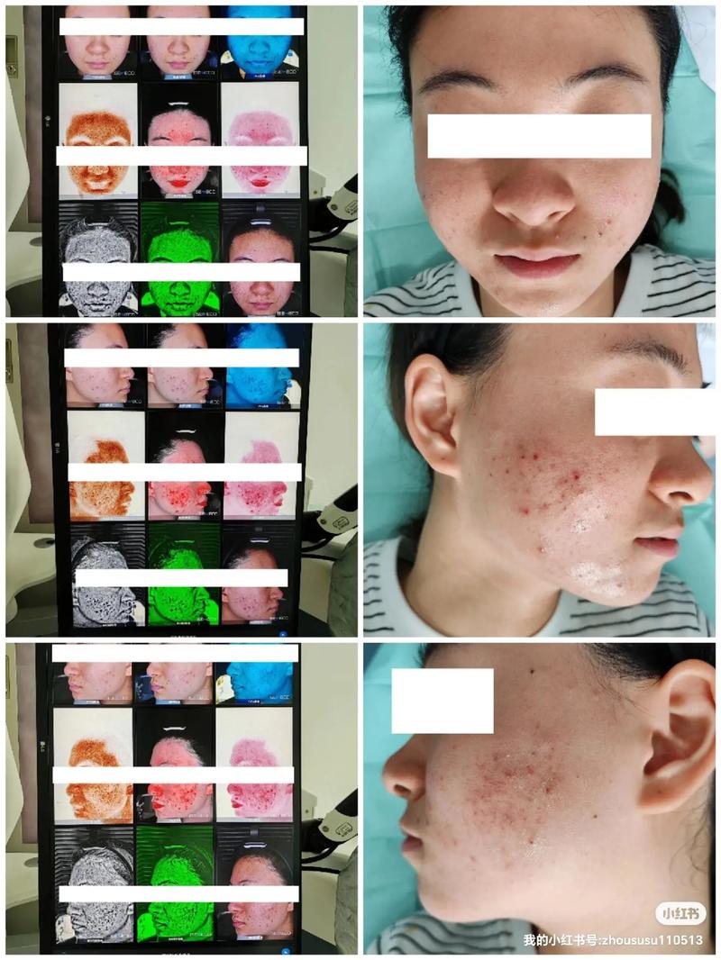 你就是怎么看完知道了皮肤科医生视频(自己的你就东直门是怎么看完)
