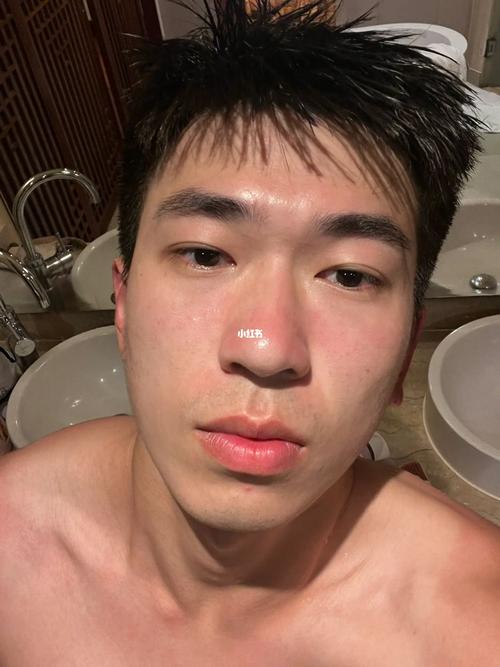 男生面部皮肤(男性皮肤防晒男生碳酸)