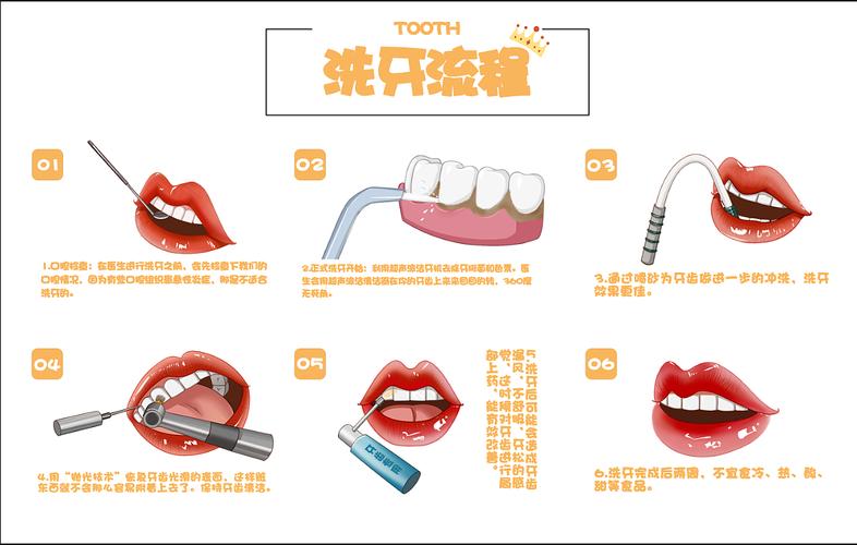 术前流程事项攻略洗牙(医保洗牙口腔科术前芒果)