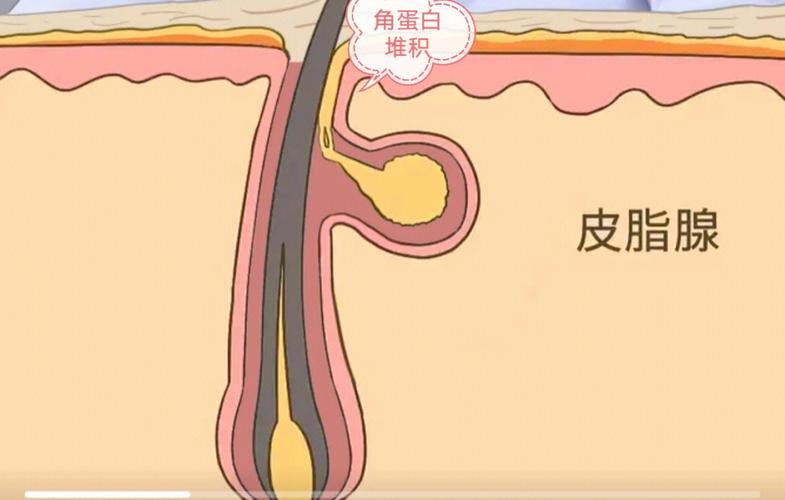 这份夏季攻略(毛发武器毛囊皮肤可持续)
