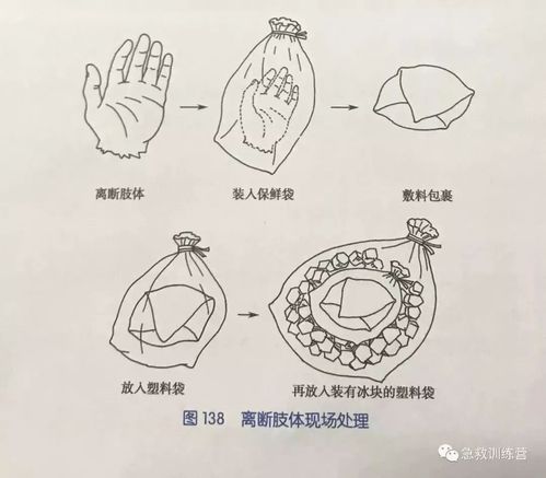 手指女士医生计划瀛洲周三(健康手臂可以选择身体医生)