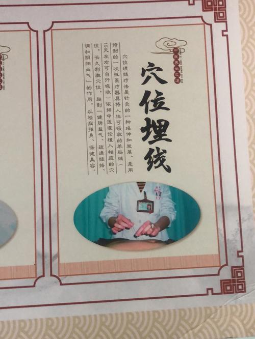 埋线穴位简介(穴位埋线针刺疗效效应)
