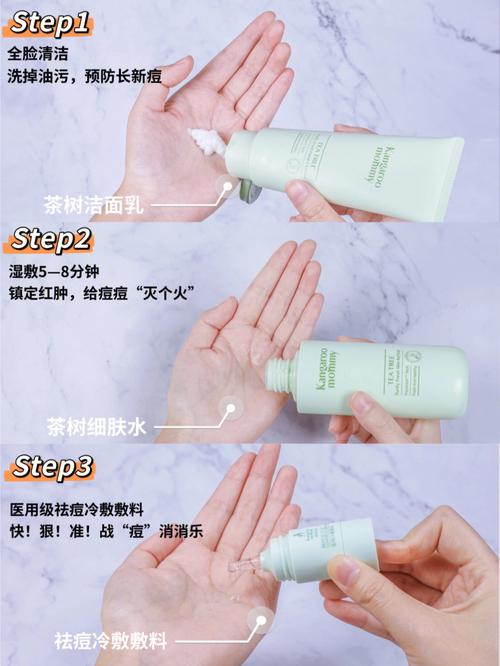 孕妇祛痘适合方法健康(孕妇祛痘适合方法健康)
