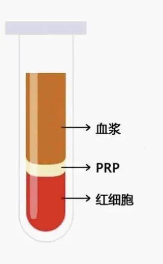 血浆凝胶活性蛋白区及生长因子(血浆凝胶活性区及蛋白)