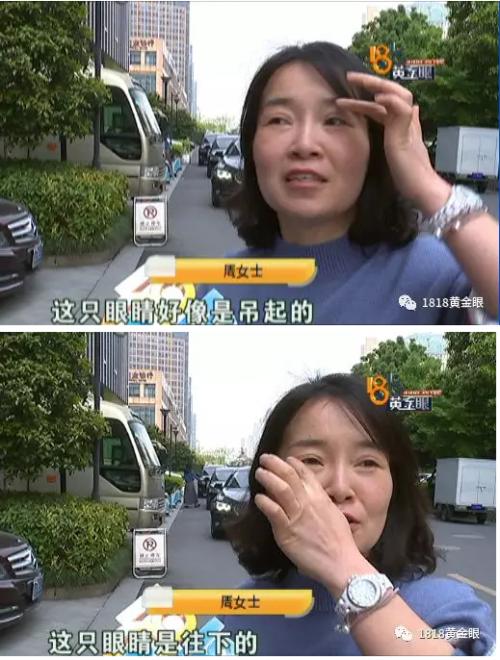杭州一大一美神眼睛医疗美容医院(眼睛杭州女士手机闽南)