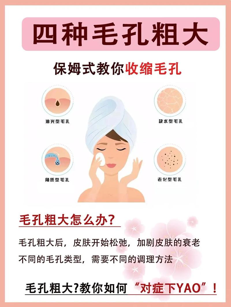 粗大我那黑头毛孔拿什么拯救你(毛孔粗大黑头皮肤我那)