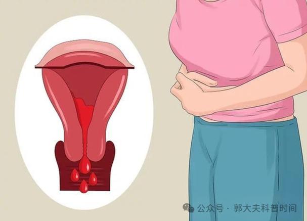 都要告诉你整形美容月经期(手术月经例假医生月经期)