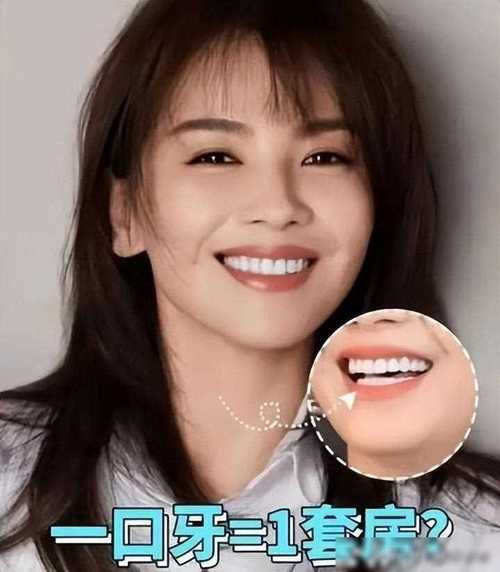 一颗重金刘涛牙就四万块(一颗重金粉丝的是都是)