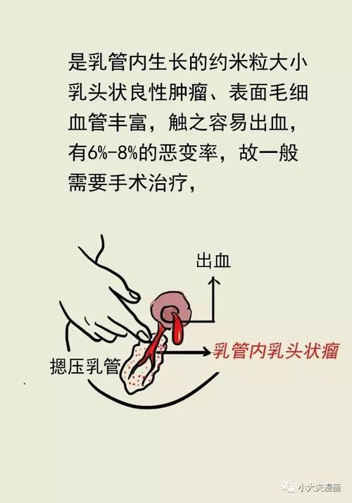 乳头最美比例位置平台美沃斯早参(乳头自己的位置能力咨询师)