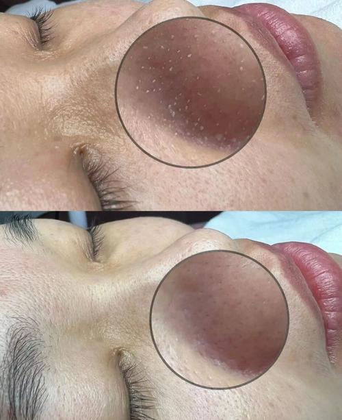 阜康毛囊新项目清洁小伙伴们项目(阜康毛囊清洁项目是个)
