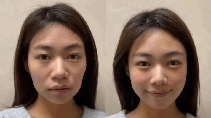 面部高阶思路项目幼态脸(面部轮廓外轮高阶耳朵)