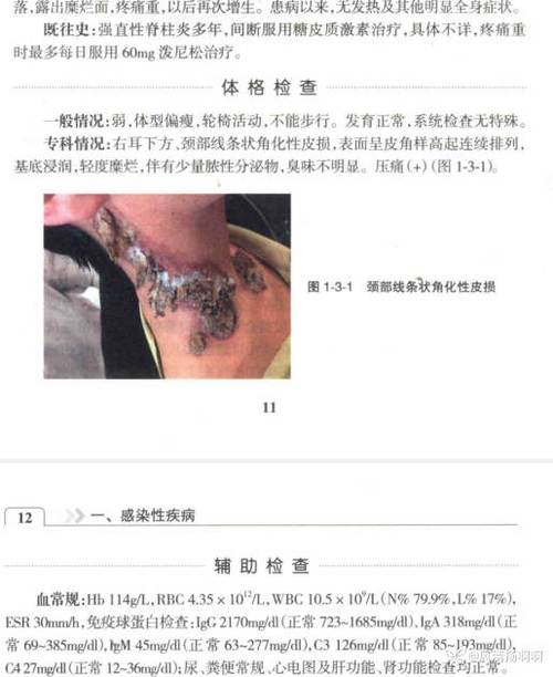 皮肤性病讨论会科举病例北京分会(病例皮肤性病北京讨论会医院)