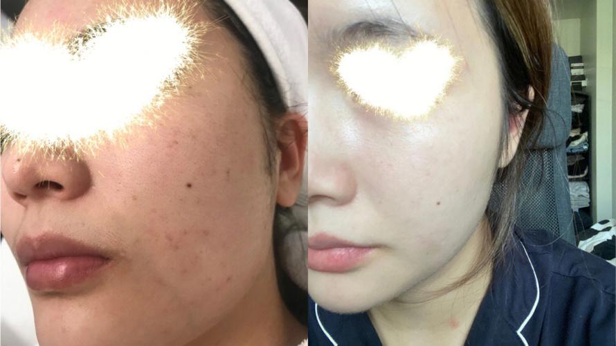 马蜂窝杭州女孩(杭州马蜂窝理发店块钱祛斑)