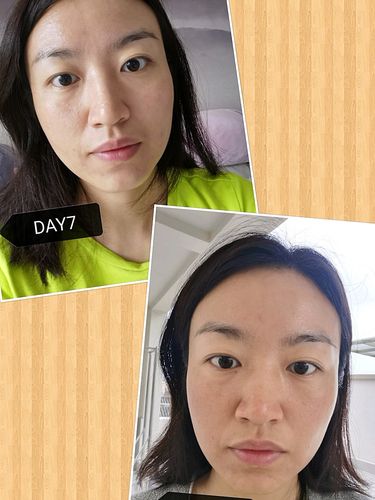 整形美容类人别做(的人手术效果专家松弛)