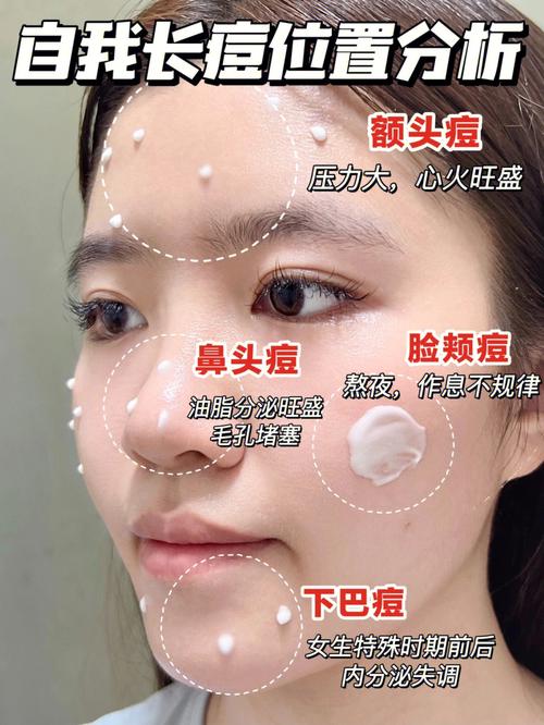 都有想做光电战痘(点阵深圳市皮肤项目深圳)