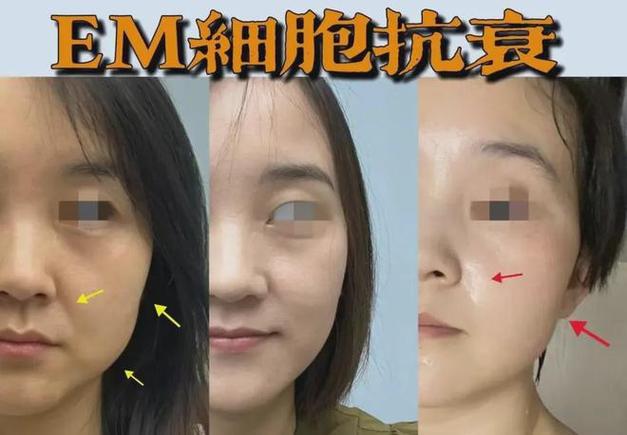 扬州美肤福利攻略手慢无(扬州福利美肤攻略黑头)