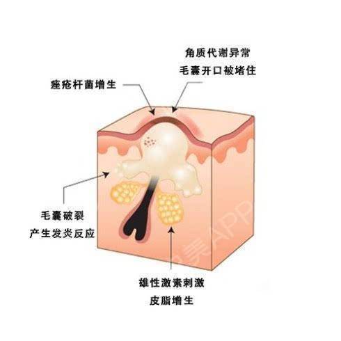凝脂女生收藏(凝脂就可以皮肤梅花鹿女生)