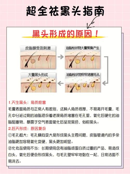 都在教你毛孔技巧去黑头林心(毛孔都在教你去黑头技巧)