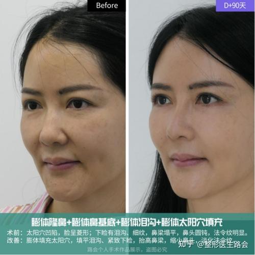面部天后全程女士大变样(面部天后全程必究女士)