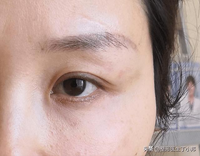 干货更有效无神眼睛丁小邦眼周抗衰(干货无神更有效眼睛情况下)
