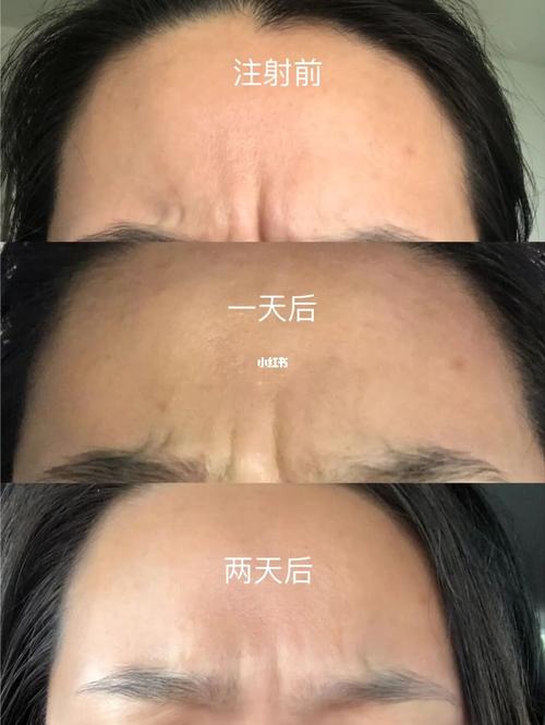 还会男士项目世纪做医美(支架还会面部男士自己的)
