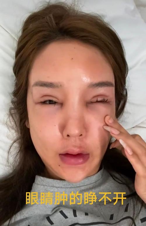 去了脸都女子想变美(女士去了脸都贵溪市女子)