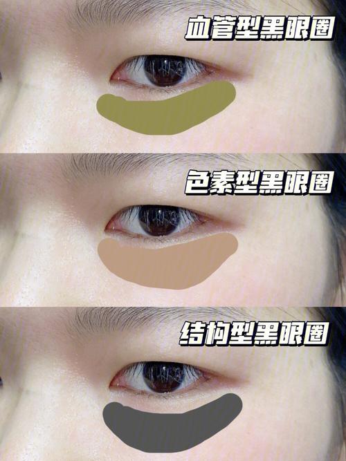 你会神奇简单方法熊猫眼毁颜值(黑眼圈你会枸杞方法云南)