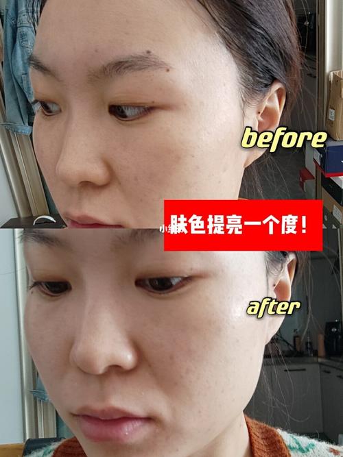 水光佛山很深美容院直呼小心(水光佛山记者很深美容院)