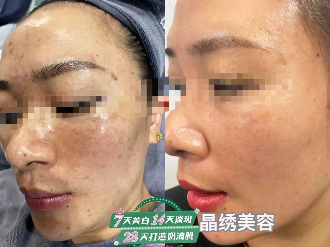 同城美容护肤(溪水风趣水光同城面部)