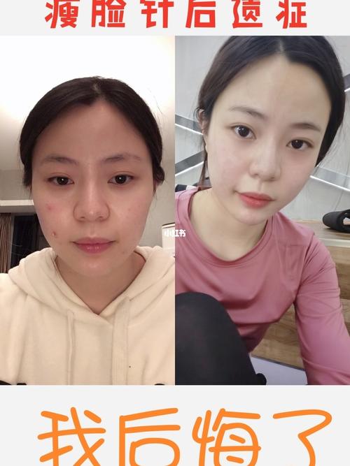 都说十多我老瘦脸女子项目(十多都说瘦脸我老女子)