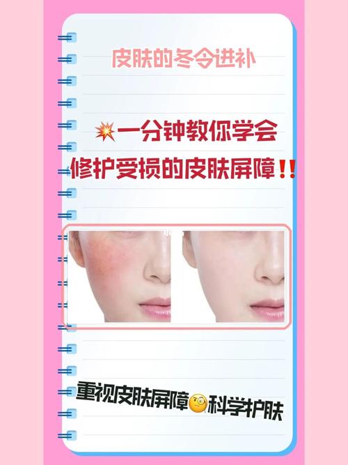时间段教你如何皮肤指南(皮肤时间段教你如何指南屏障)