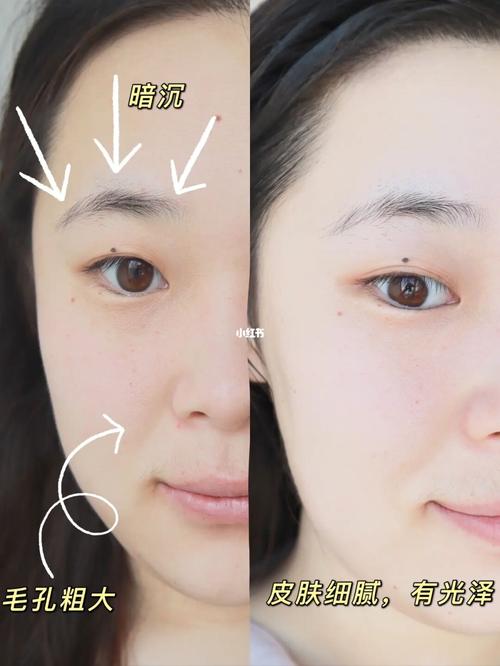 要先这几个奶油皮肤瓷娃娃(毛孔皮肤奶油要先黑头)