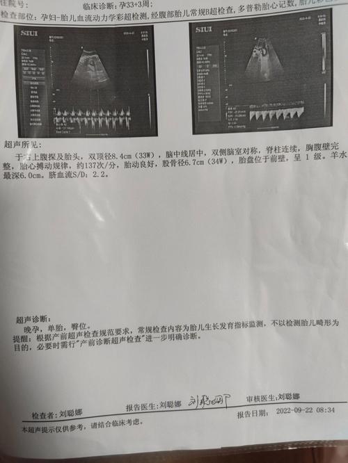 赣州来了美中不足超声分局市场监管(医疗美容喀什市赣州株洲株洲市)