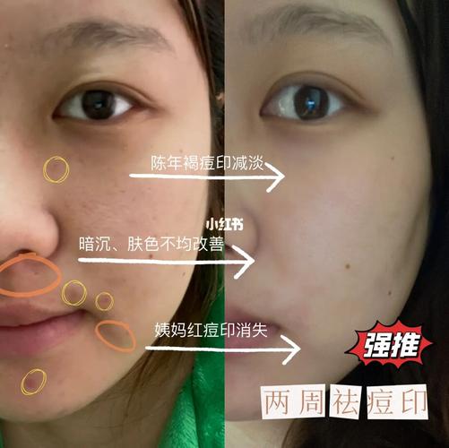秘籍换脸(秘籍换脸皮肤毛孔韩国)