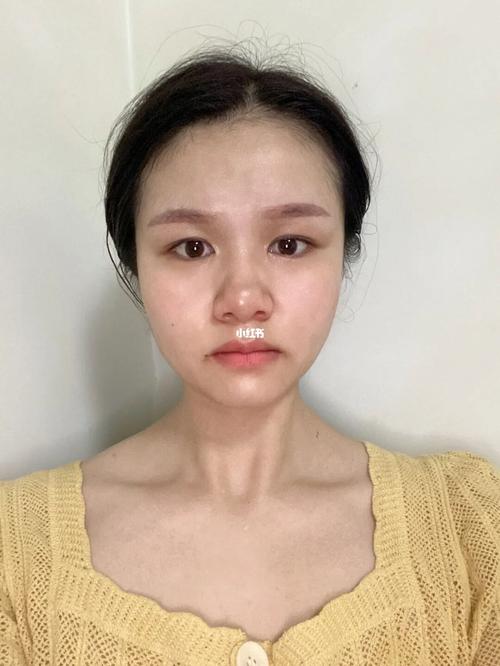 真相(真相尿酸皮肤医生脸型)