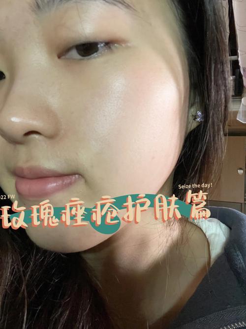 脸颊咋办出油多毛(痤疮脸颊护肤品孕妇出油)