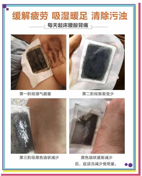帮你躺着薏仁足贴祛湿LV(帮你湿气躺着足贴薏仁)