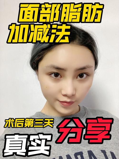 加减法做个脸上(面部齐鲁脂肪加减法做个)