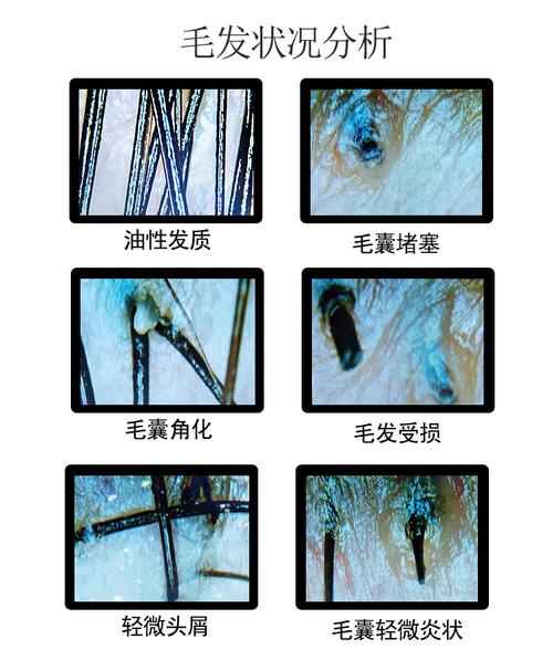 头皮医学方案时尚Haircare(头皮产品毛囊医学毛发)