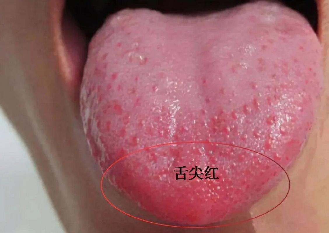 最简单(舌头舌尖作用效果很好)