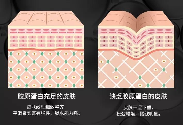 射频胶原蛋白(射频胶原蛋白蛋白质微循环皮肤)