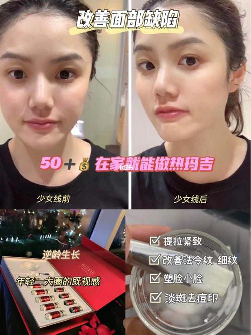在线几天效果好岁做线雕热玛吉(在线几天面部效果好皮肤)