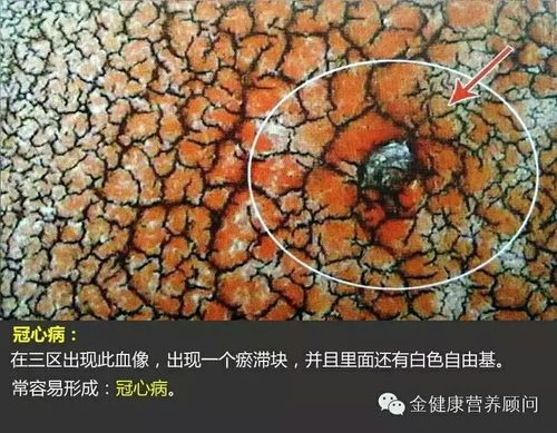 就能长春一滴血疾病美丽所内(就能长春美丽长春市一滴血)