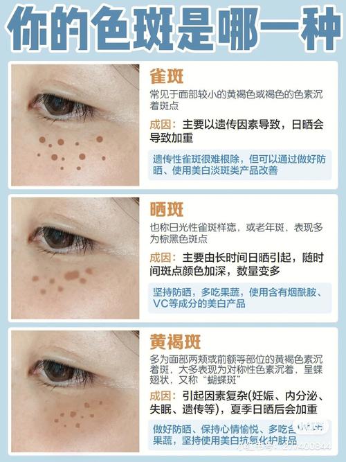 斑痕只需把它黄褐斑雀斑顽固(斑痕雀斑只需把它黄褐斑)