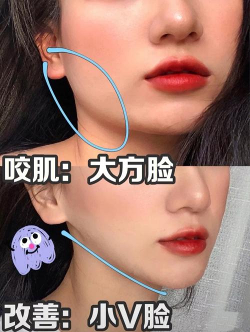 面部方法有哪些(面部瘦脸有哪些医学方法)