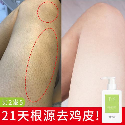 这款鸡皮不入秋冬身体亮肤去(鸡皮身体这款秋冬果酸)