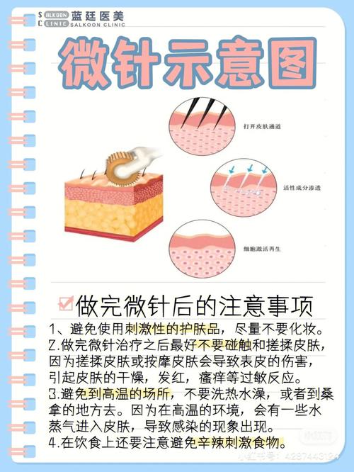 水光哪种效果滚针(水光皮肤效果哪种滚针)