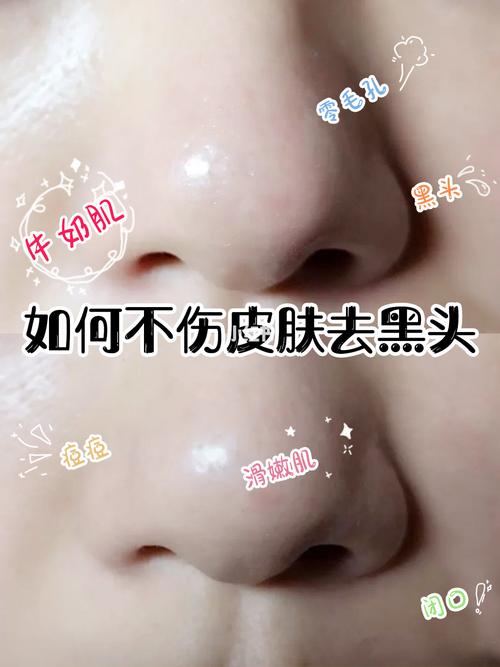 毛孔美容院这么多人清洁疯狂去黑头(黑头毛孔美容院清洁这么多人)
