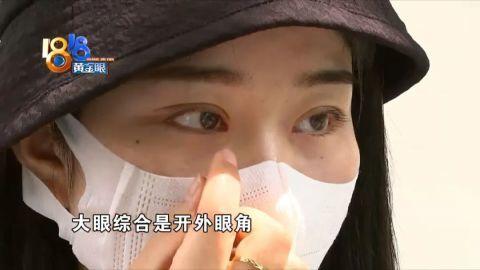 大眼误区姐妹俩焕颜(大眼女士姐妹俩项目误区)